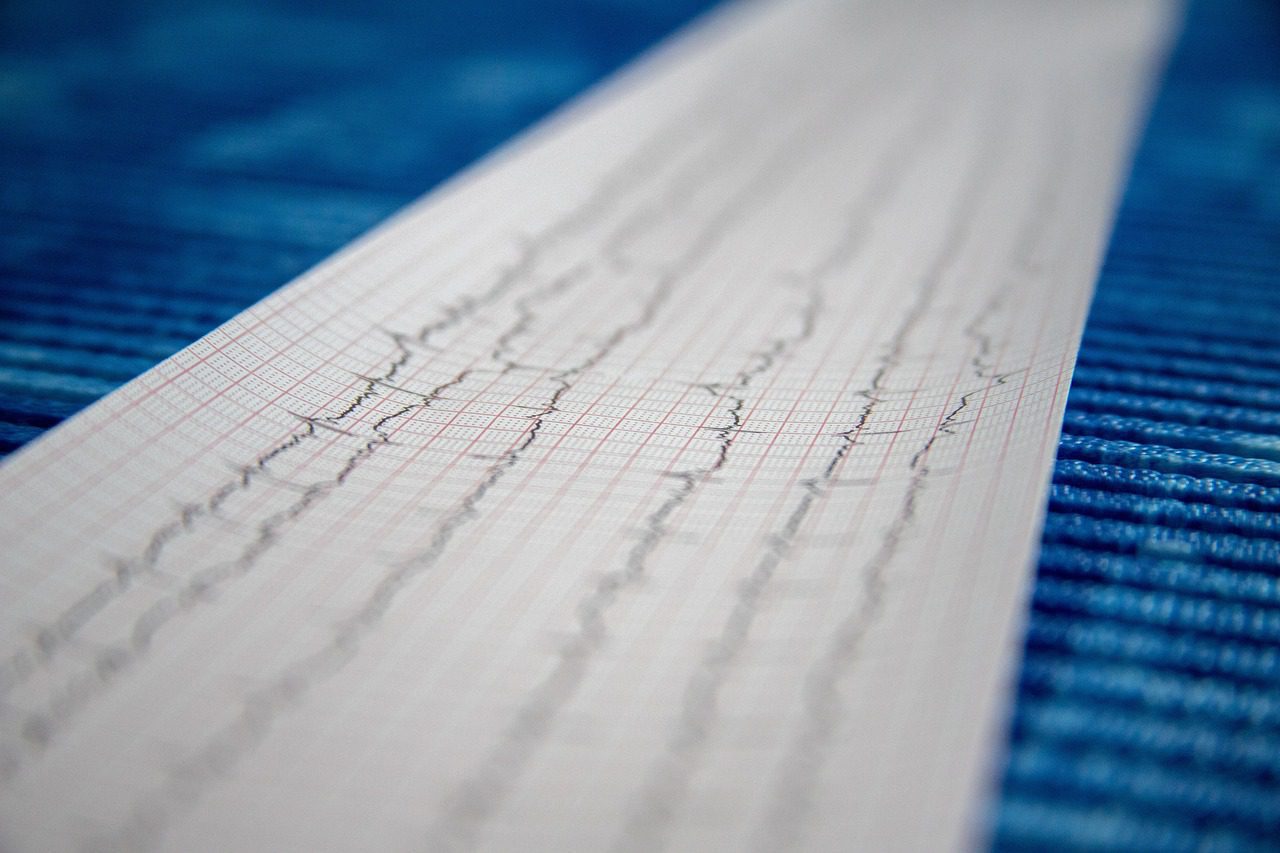 veterinary, ecg, record